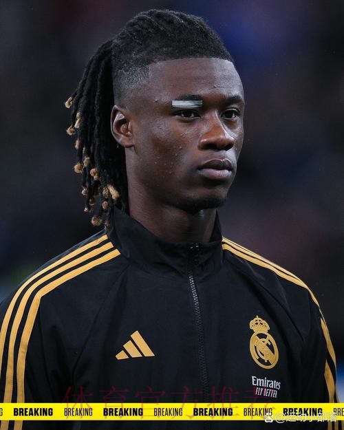 卡马文加预计伤缺3周 皇马将检查他韧带是否受伤